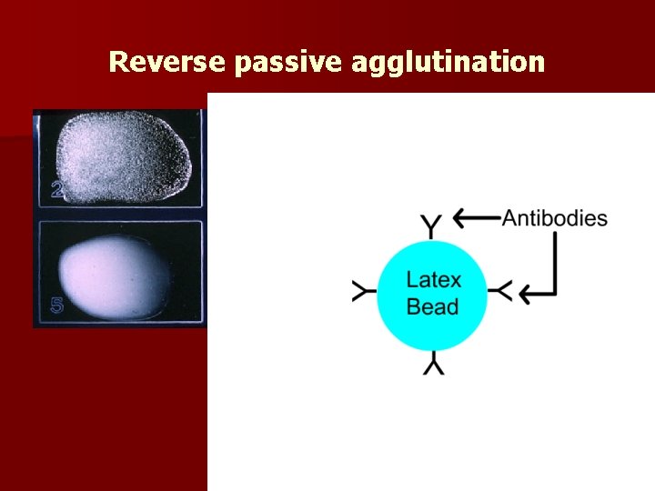 Reverse passive agglutination Involves the adherence of Ab n to inert particles which can