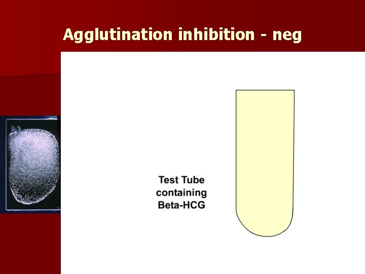 Agglutination inhibition - neg 