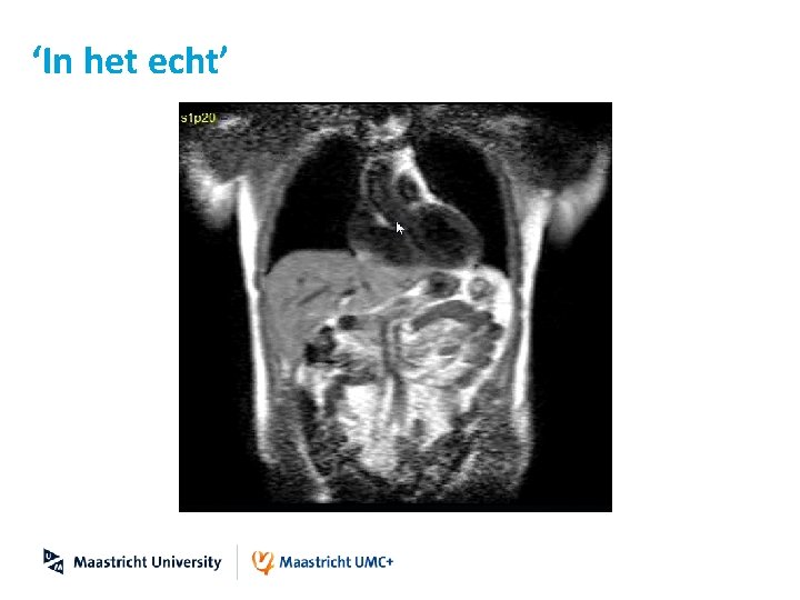 ‘In het echt’ 