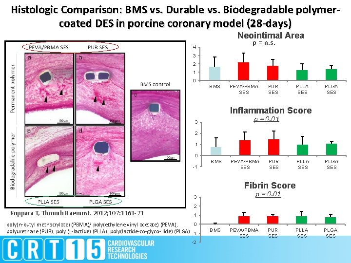 Histologic Comparison: BMS vs. Durable vs. Biodegradable polymercoated DES in porcine coronary model (28