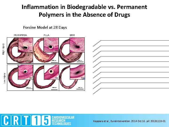 Inflammation in Biodegradable vs. Permanent Polymers in the Absence of Drugs Porcine Model at