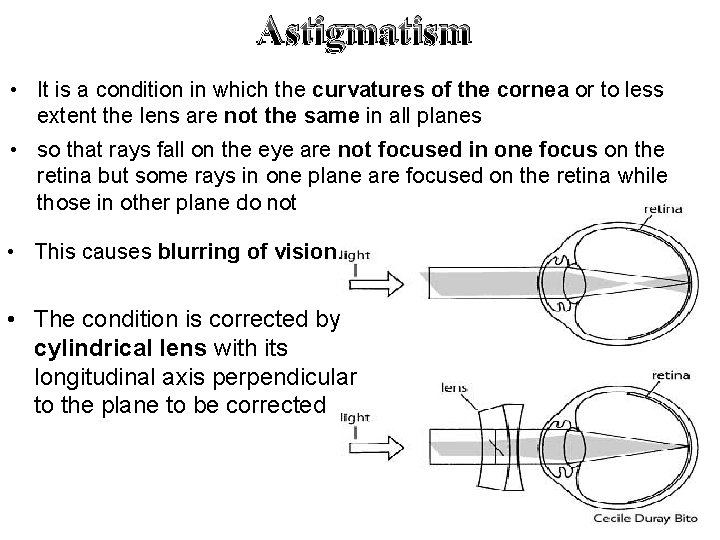 Astigmatism • It is a condition in which the curvatures of the cornea or