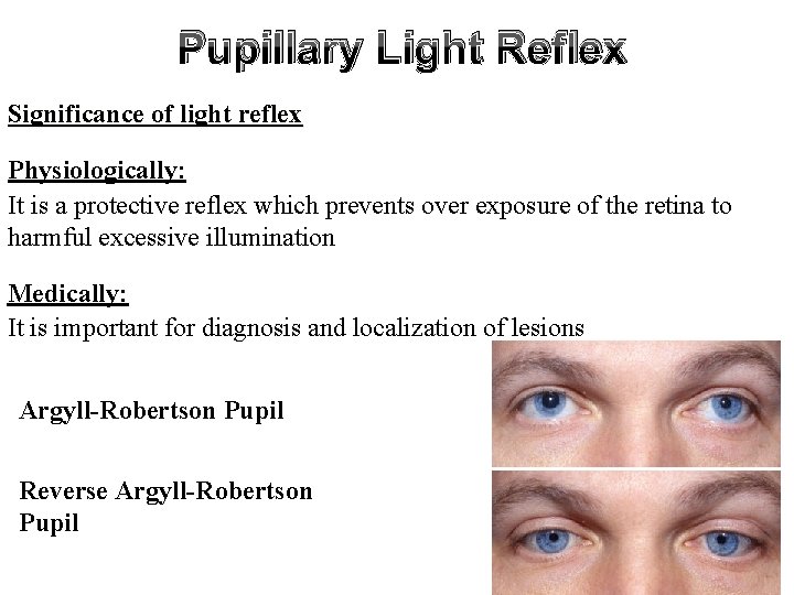 Pupillary Light Reflex Significance of light reflex Physiologically: It is a protective reflex which