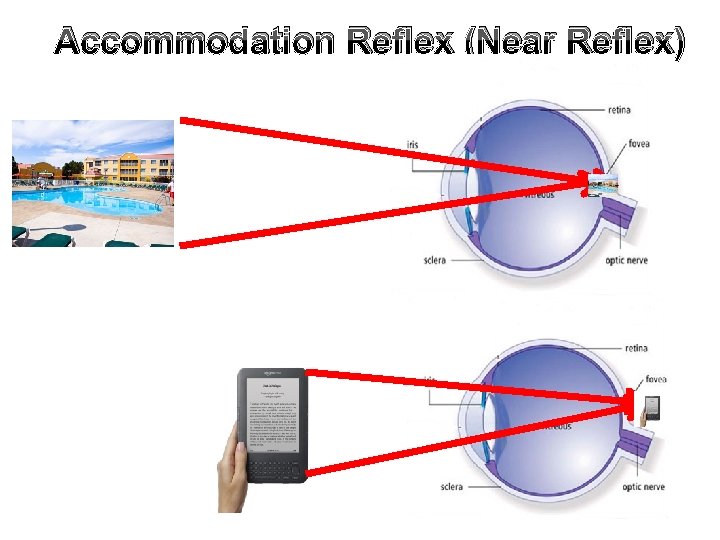 Accommodation Reflex (Near Reflex) 