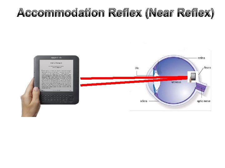 Accommodation Reflex (Near Reflex) 