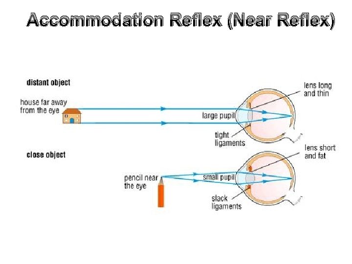 Accommodation Reflex (Near Reflex) 