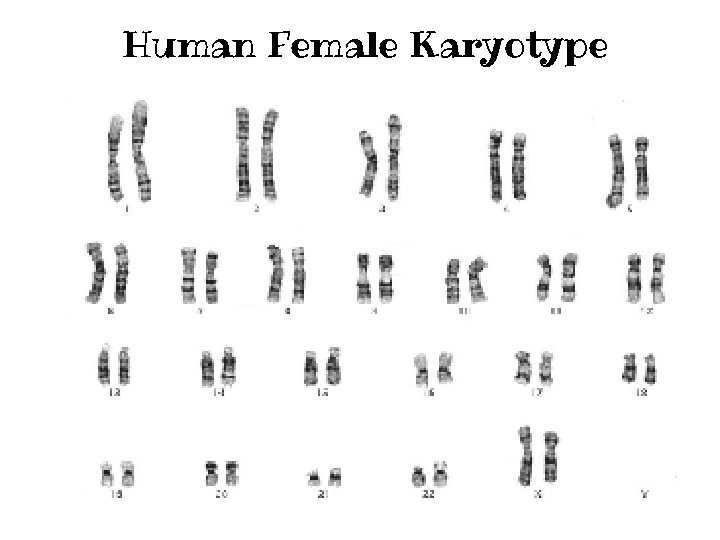 Human Female Karyotype 