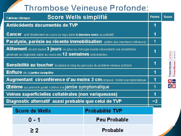  Thrombose Veineuse Profonde: Tableau clinique Score Wells simplifié Antécédents documentés de TVP Points