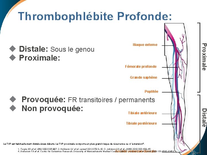  Thrombophlébite Profonde: Fémorale profonde Proximale u Distale: Sous le genou u Proximale: Iliaque