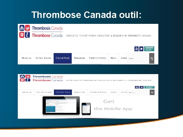 Thrombose Canada outil: 
