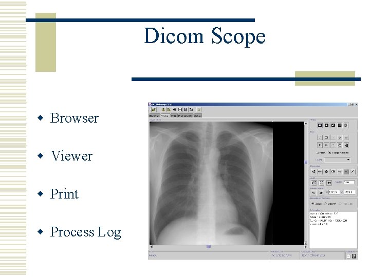 Dicom Scope w Browser w Viewer w Print w Process Log 