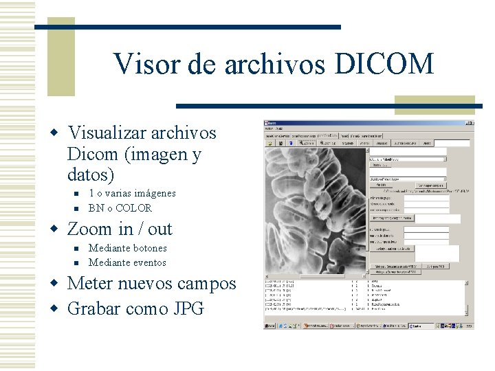 Visor de archivos DICOM w Visualizar archivos Dicom (imagen y datos) n n 1