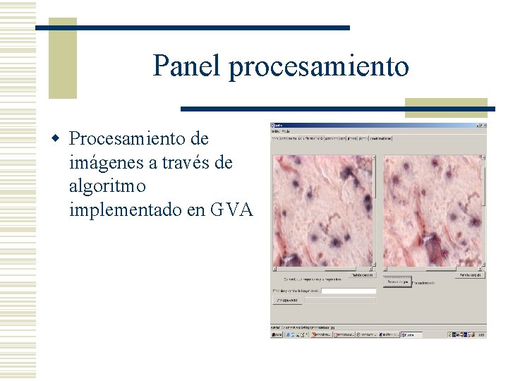 Panel procesamiento w Procesamiento de imágenes a través de algoritmo implementado en GVA 