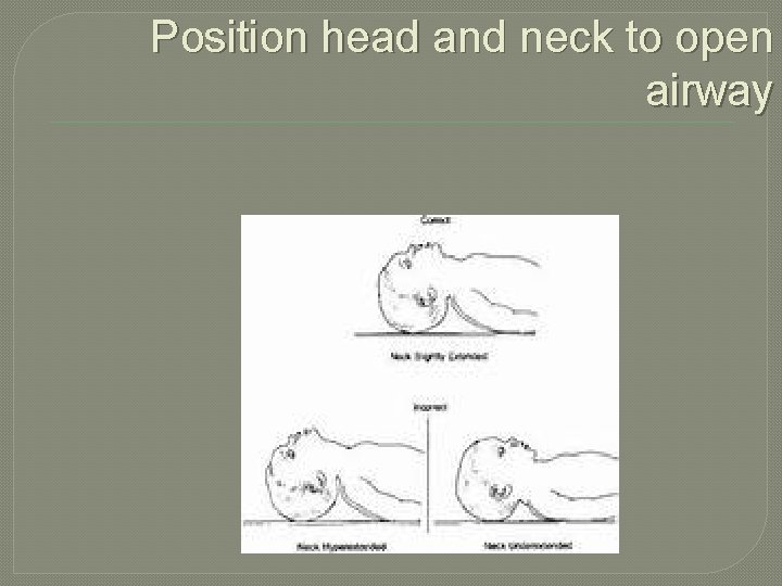 Position head and neck to open airway 