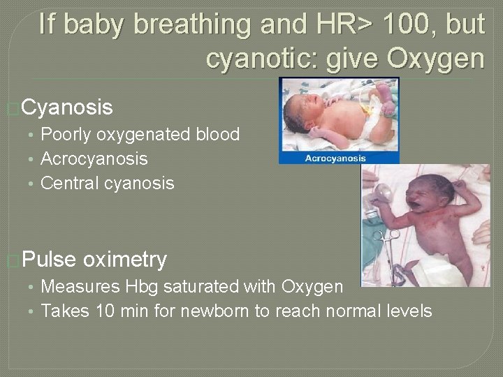 If baby breathing and HR> 100, but cyanotic: give Oxygen �Cyanosis • Poorly oxygenated