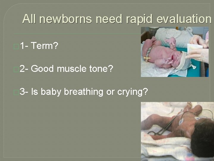All newborns need rapid evaluation � 1 - Term? � 2 - Good muscle