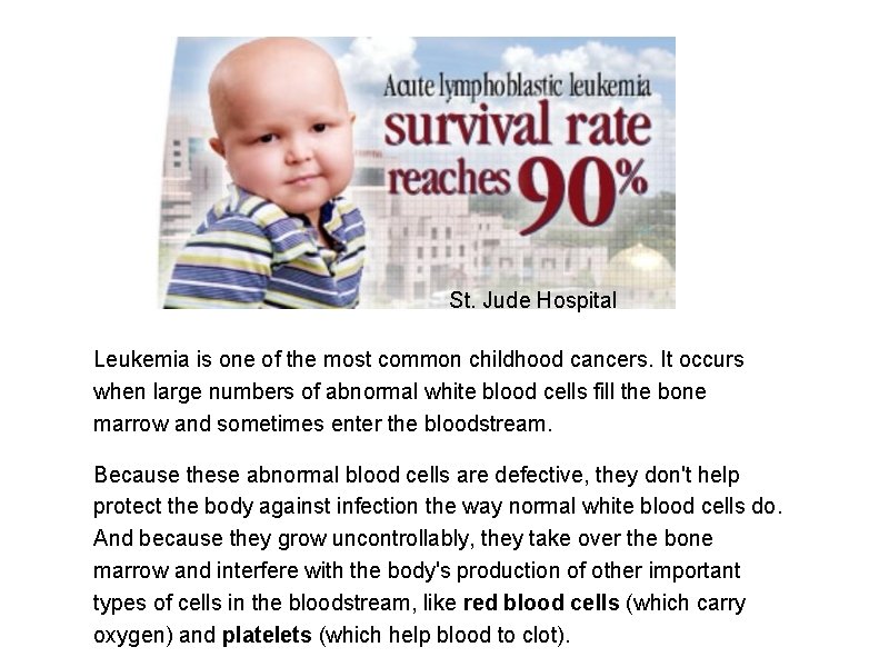 St. Jude Hospital Leukemia is one of the most common childhood cancers. It occurs