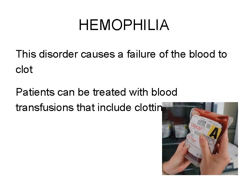 HEMOPHILIA This disorder causes a failure of the blood to clot Patients can be