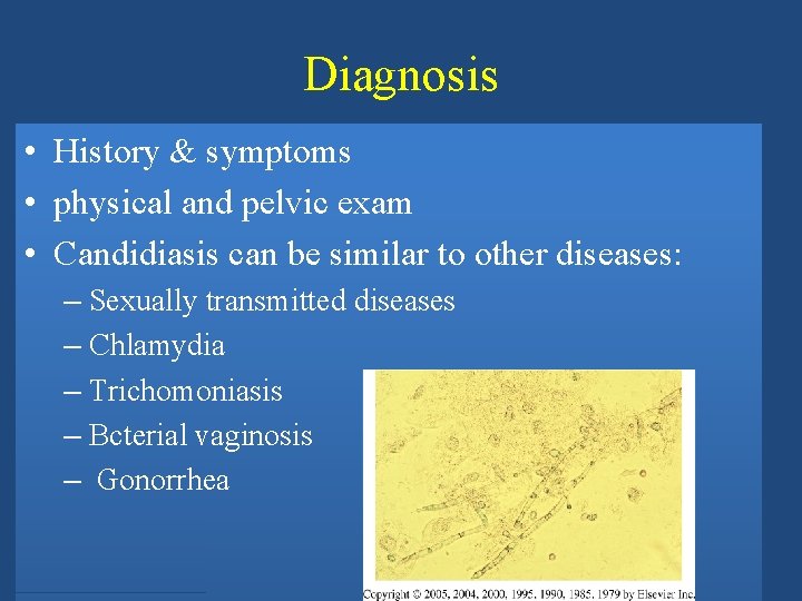 Diagnosis • History & symptoms • physical and pelvic exam • Candidiasis can be