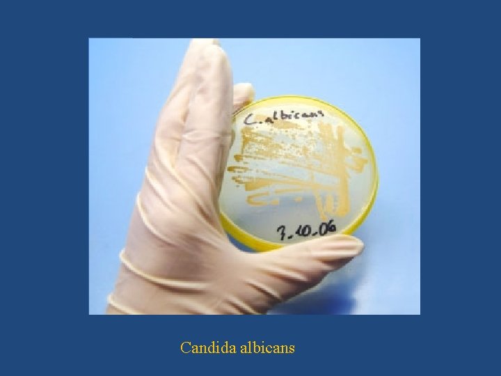Candida albicans 