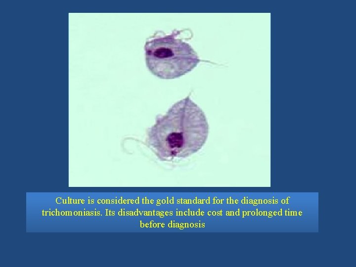 Culture is considered the gold standard for the diagnosis of trichomoniasis. Its disadvantages include