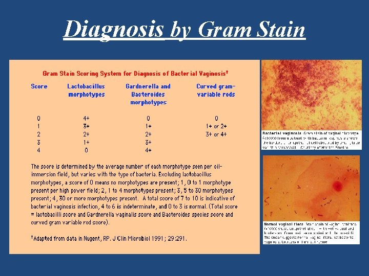 Diagnosis by Gram Stain 