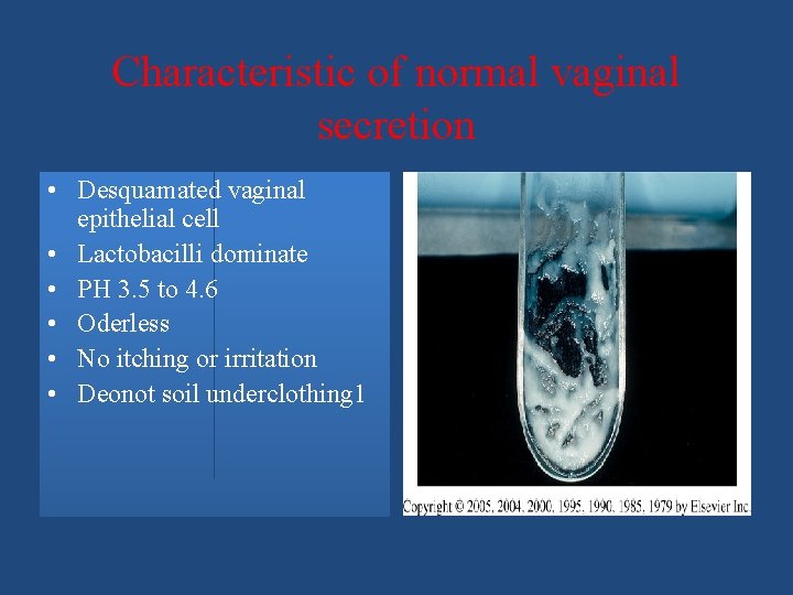 Characteristic of normal vaginal secretion • Desquamated vaginal epithelial cell • Lactobacilli dominate •