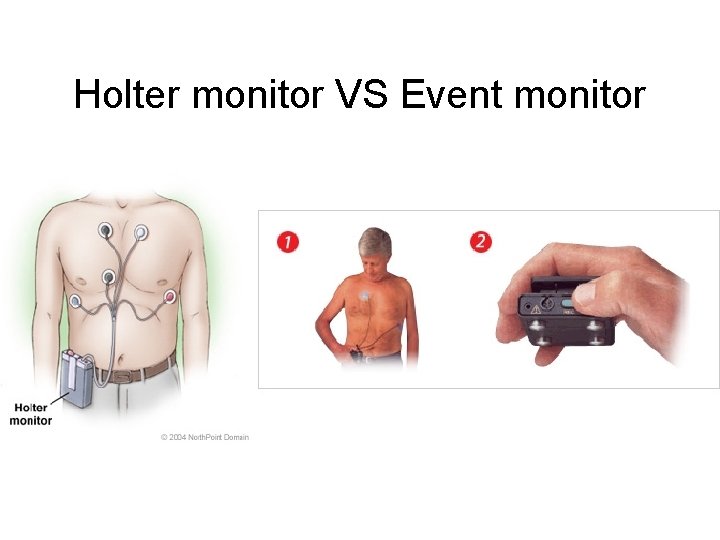Holter monitor VS Event monitor 