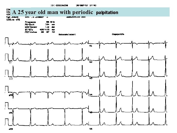 A 25 year old man with periodic palpitation 