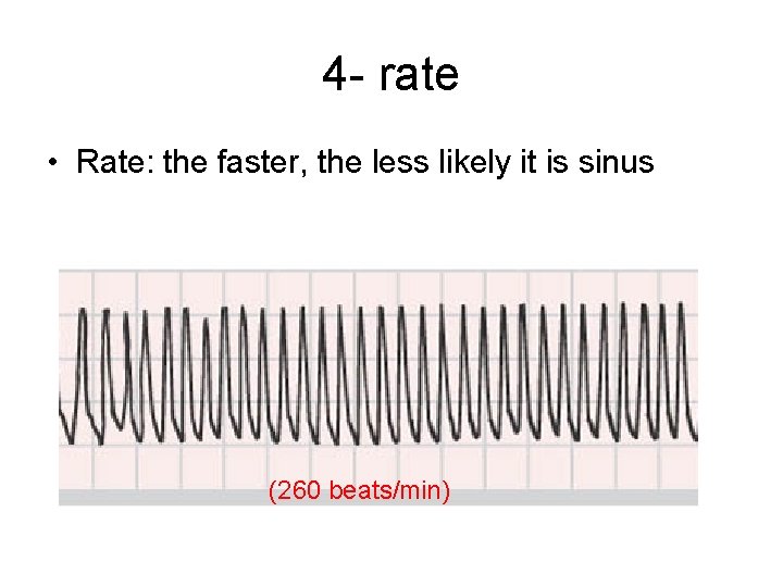 4 - rate • Rate: the faster, the less likely it is sinus (260