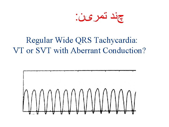 : چﻨﺪ ﺗﻤﺮیﻦ Regular Wide QRS Tachycardia: VT or SVT with Aberrant Conduction? 