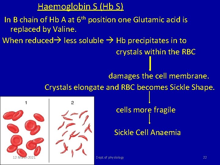  Haemoglobin S (Hb S) In Β chain of Hb A at 6 th