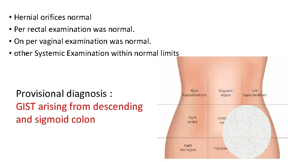  • Hernial orifices normal • Per rectal examination was normal. • On per