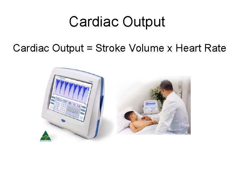 Cardiac Output = Stroke Volume x Heart Rate 