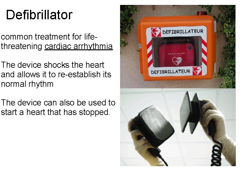 Defibrillator common treatment for lifethreatening cardiac arrhythmia The device shocks the heart and allows