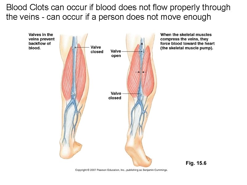 Blood Clots can occur if blood does not flow properly through the veins -