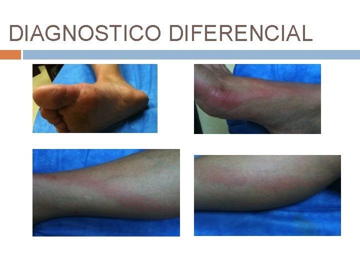 DIAGNOSTICO DIFERENCIAL 