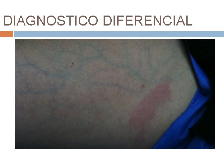 DIAGNOSTICO DIFERENCIAL 