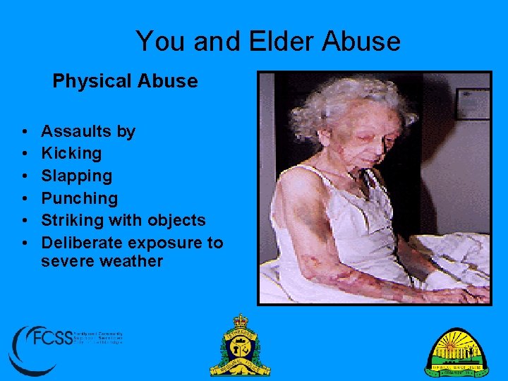 You and Elder Abuse Physical Abuse • • • Assaults by Kicking Slapping Punching