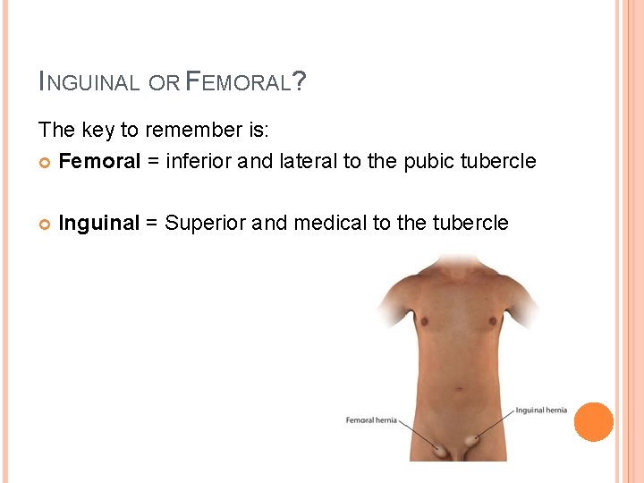 INGUINAL OR FEMORAL? The key to remember is: Femoral = inferior and lateral to
