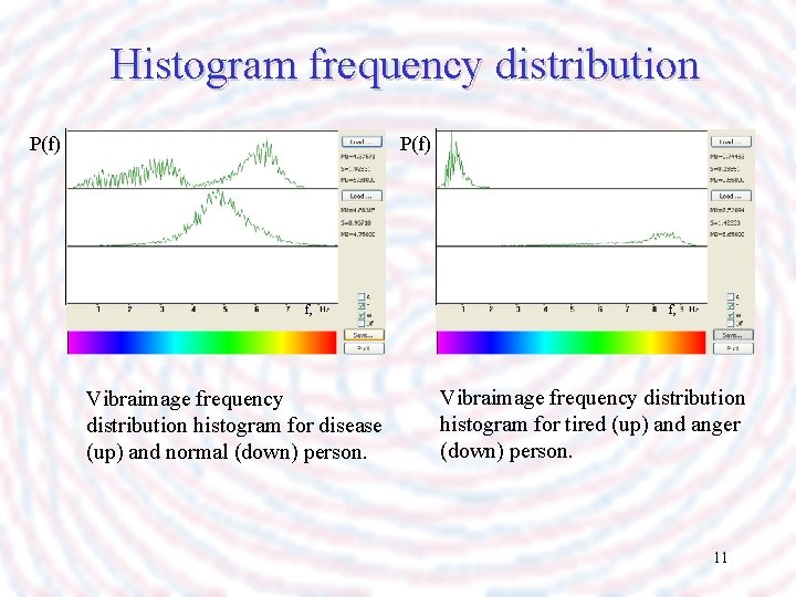 Histogram frequency distribution P(f) f, Vibraimage frequency distribution histogram for disease (up) and normal