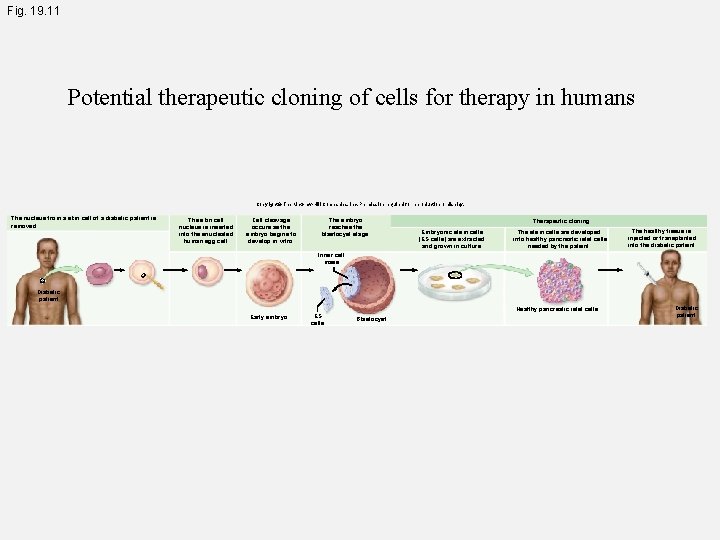 Fig. 19. 11 Potential therapeutic cloning of cells for therapy in humans Copyright ©