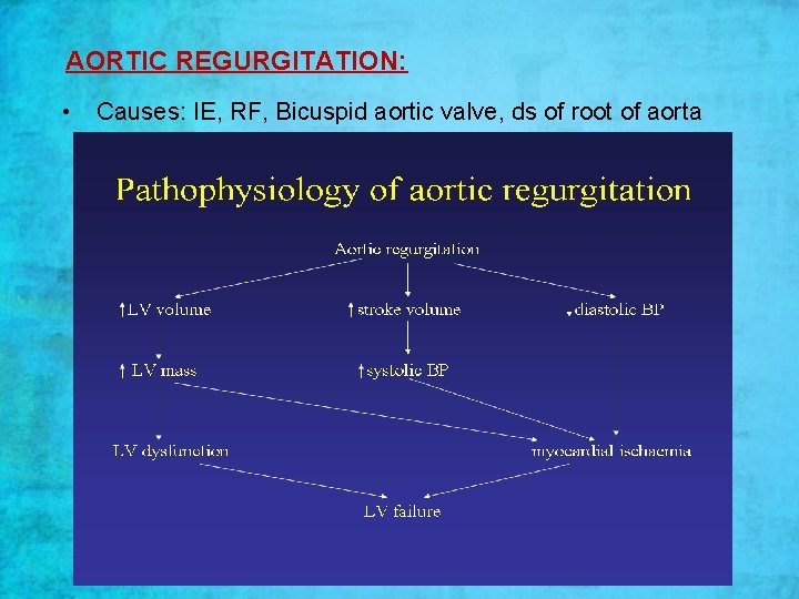 AORTIC REGURGITATION: • Causes: IE, RF, Bicuspid aortic valve, ds of root of aorta