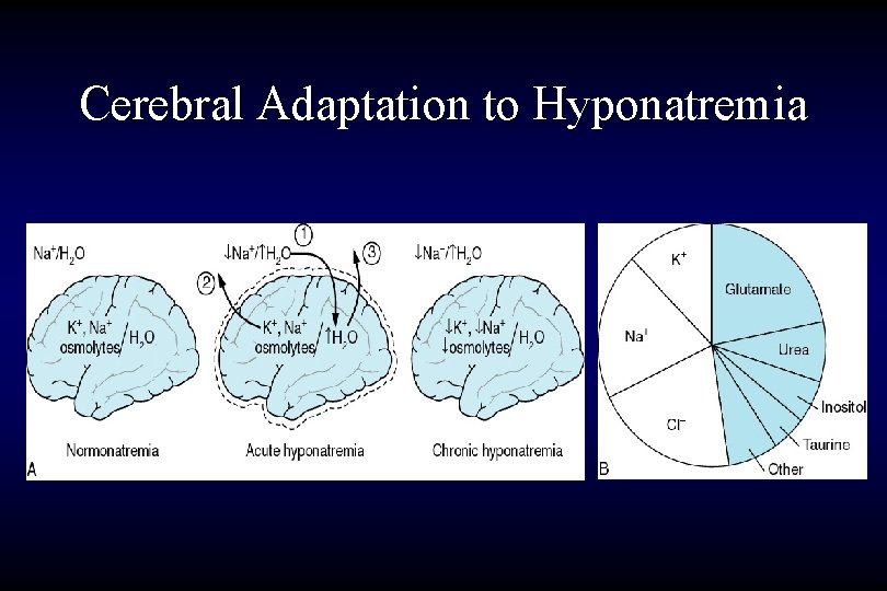 Cerebral Adaptation to Hyponatremia 