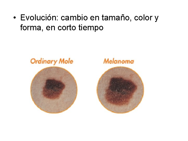  • Evolución: cambio en tamaño, color y forma, en corto tiempo 