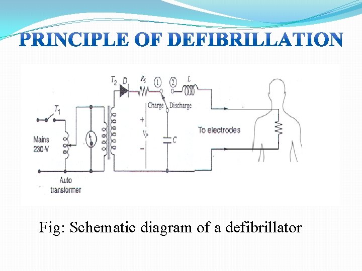 Fig: Schematic diagram of a defibrillator 