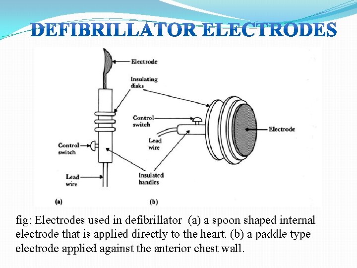 fig: Electrodes used in defibrillator (a) a spoon shaped internal electrode that is applied