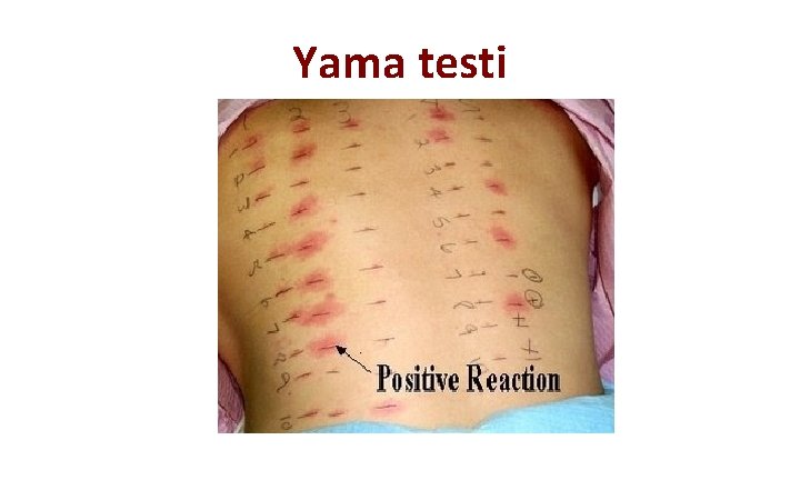 Yama testi 