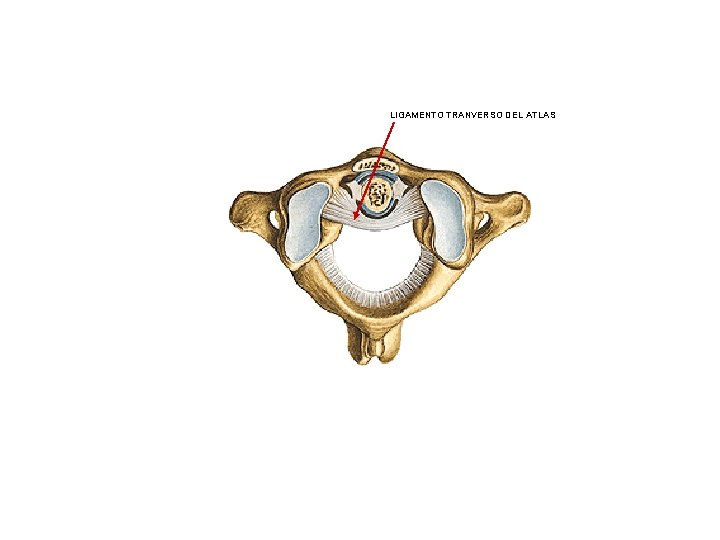 LIGAMENTO TRANVERSO DEL ATLAS 