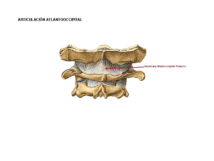 ARTICULACIÓN ATLANTOOCCIPITAL Membrana Atlantooccipital Posterior 